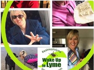 Glasgow woman who forgot friends’ names and how to drive