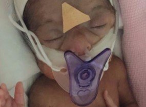 Miracle premature sick baby flown home from Dubai
