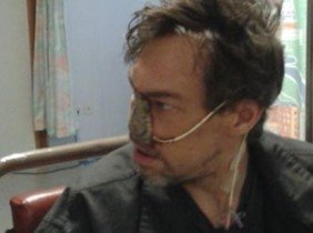 Get Stevie back on his feet