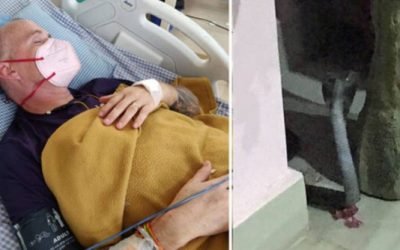 Charity worker blinded by a cobra